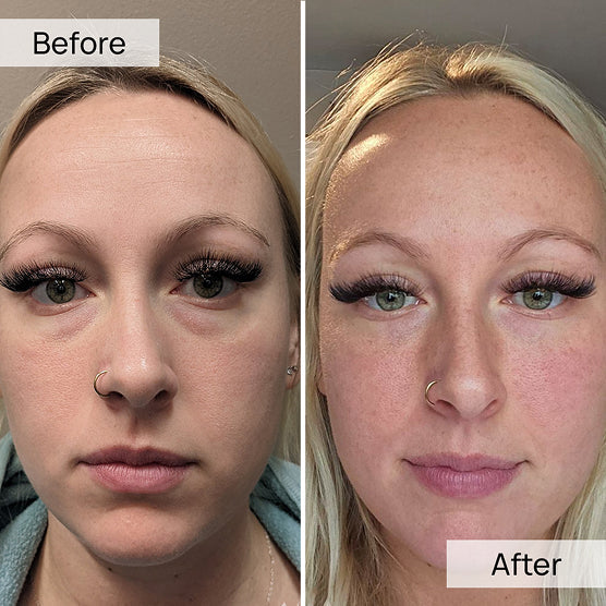 100% Volufiline 30ml Face Serum
