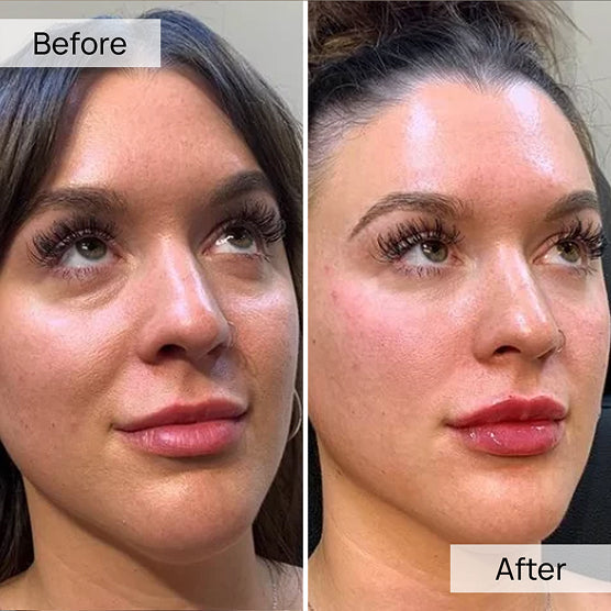 100% Volufiline 30ml Face Serum