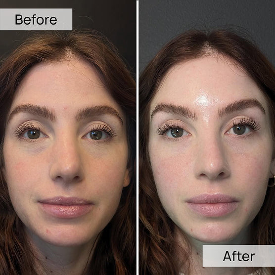 100% Volufiline 30ml Face Serum