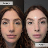 100% Volufiline 30ml Face Serum